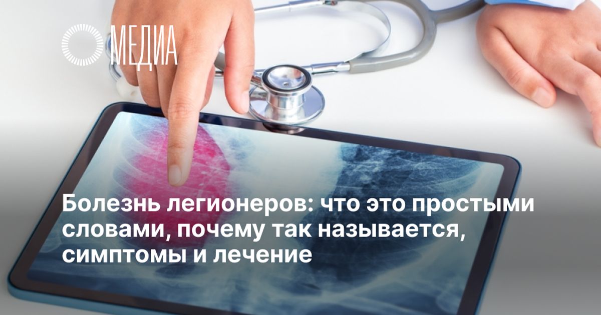 Почему при болезни бехтерева опухает колено. Болезнь Бехтерева: симптомы, диагностика и методы лечения Болезнь Бехтерева - диагностика и лечение в 100med Болезнь бехтерева: симптомы, диагностика, лечение, прогноз и профилактика